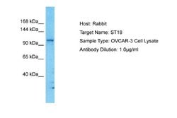 ST18 Rabbit anti-Human, Polyclonal, Novus Biologicals 0.1ml; Unconjugated:Antibodies,